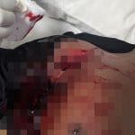Adu Mulut Berakhir Berdarah, Empat Personel Brimob Jadi Korban Penikaman di Manggarai Barat