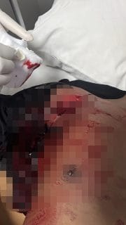 Adu Mulut Berakhir Berdarah, Empat Personel Brimob Jadi Korban Penikaman di Manggarai Barat