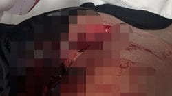 Adu Mulut Berakhir Berdarah, Empat Personel Brimob Jadi Korban Penikaman di Manggarai Barat